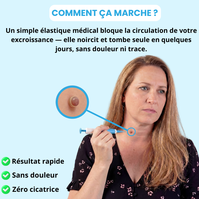 Skinmova Kit Peau Claire