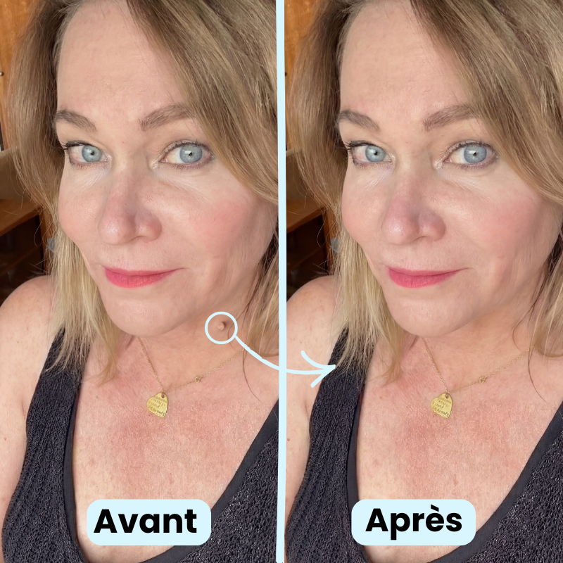 Skinmova Kit Peau Claire