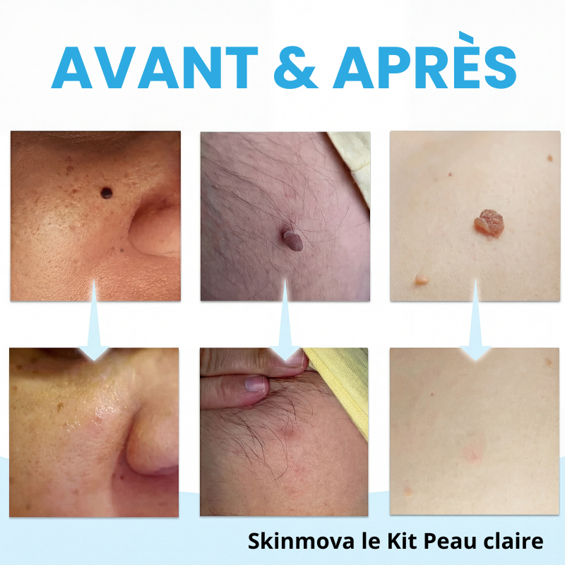 Skinmova Kit Peau Claire